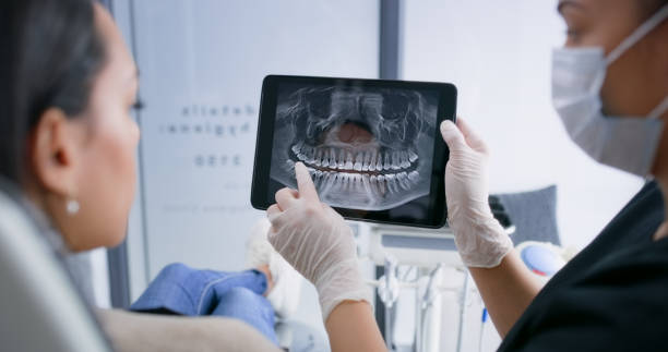 Licensed Teeth Whitening service in Barview, OR - Smile Center Dentistry